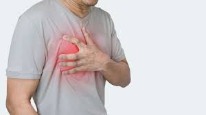 Cardiac Arrest