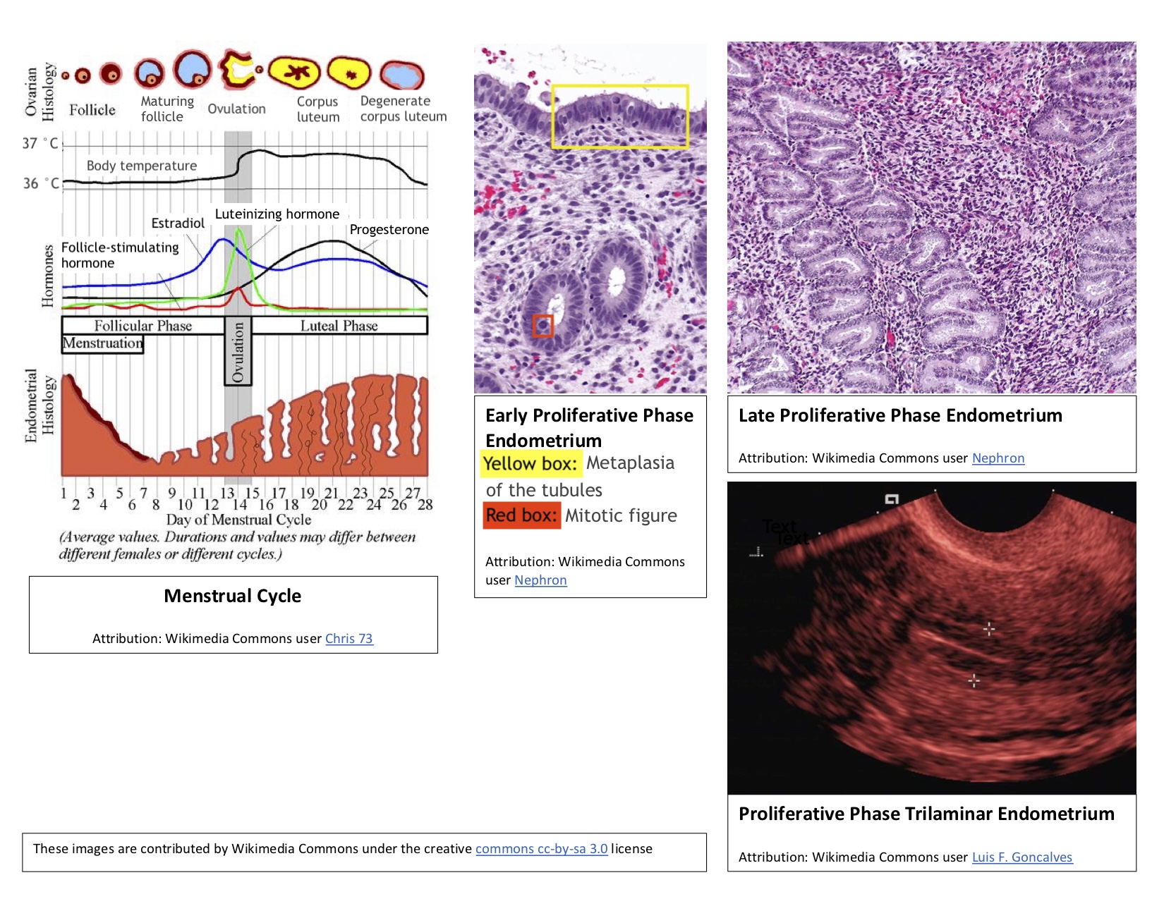 <p>Proliferative Phase Endometrium During the Menstrual Cycle