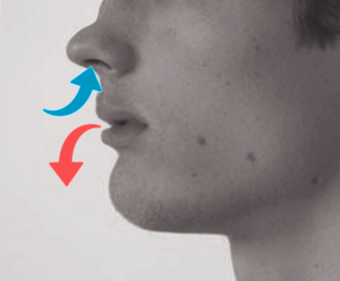 <p>Pursed-Lip Breathing