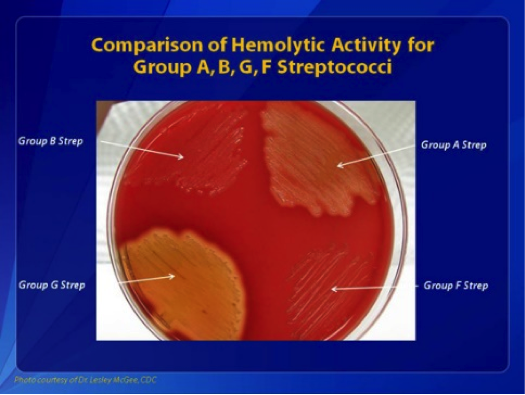 <p>Comparisons of Hemolytic Activity of&nbsp;Groups A, B, G, and F Streptococci