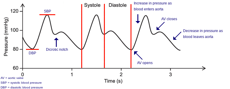 <p>Arterial Waveform</p>