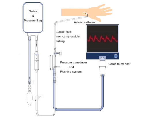 <p>Arterial Line Setup</p>