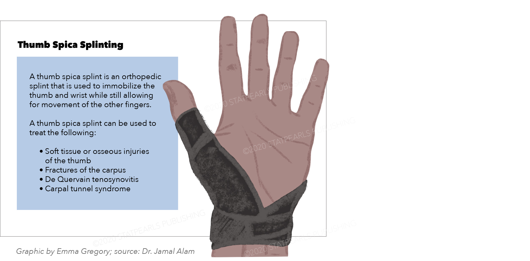 <p>Thumb Spica&nbsp;Splint
