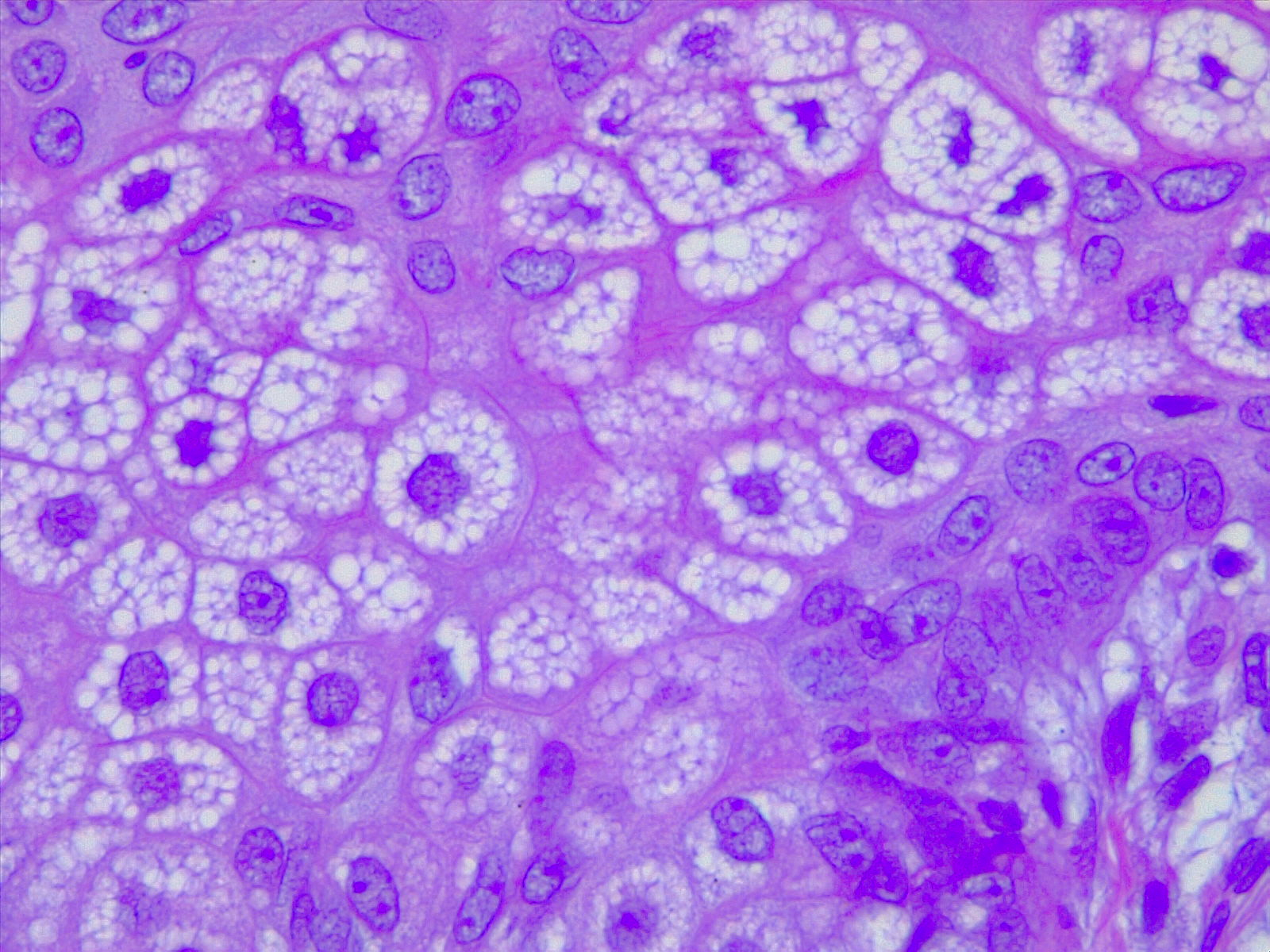 <p>Sebocytes, Sebaceous Gland Cells. H/E 40&times; Magnification.</p>