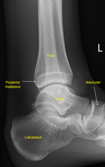 <p>Ankle Joint&nbsp;Anatomy. Lateral x-ray of the left ankle.</p>