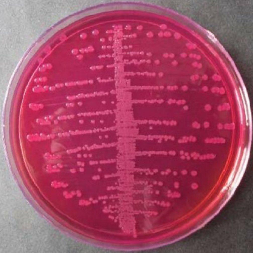 Escherichia coli on MacConkey agar.