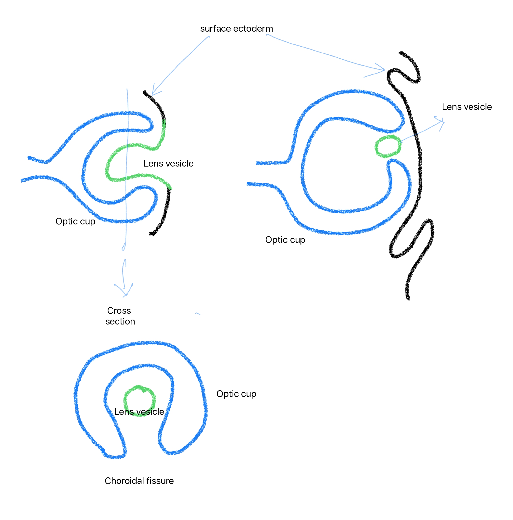 <p>Choroidal Fissure and Lens Vesicle