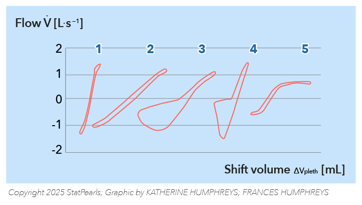 <p>Measurement of Airway Resistance