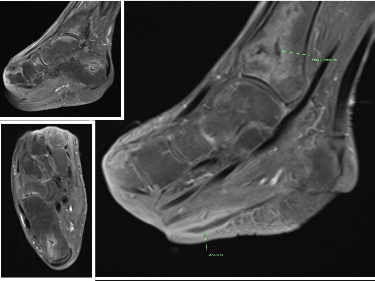 <p>Wound Imaging