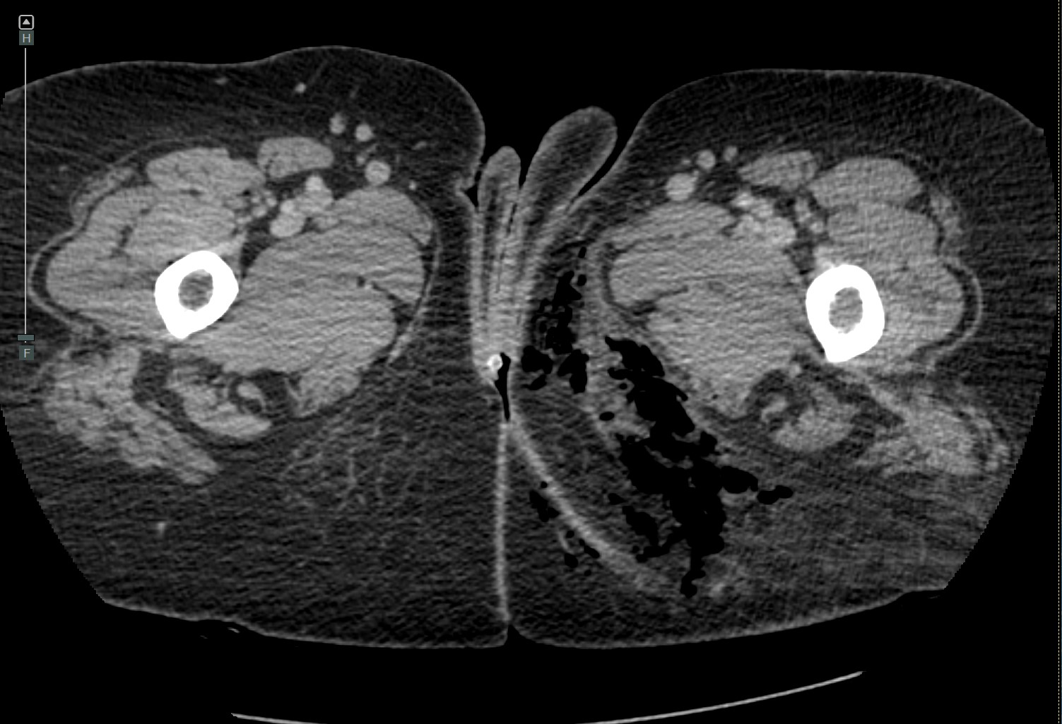 <p>Wound Imaging