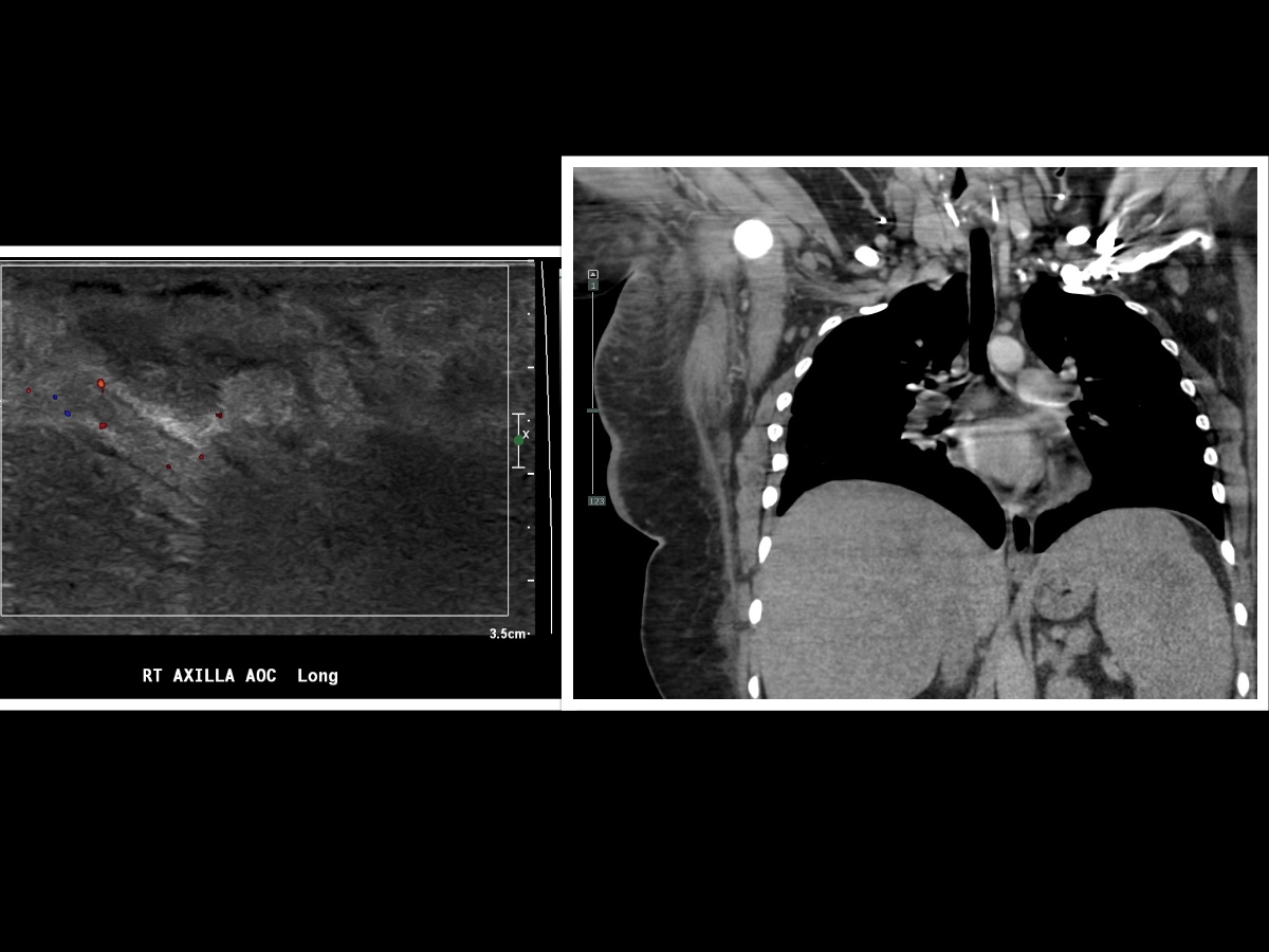 <p>Wound Imaging