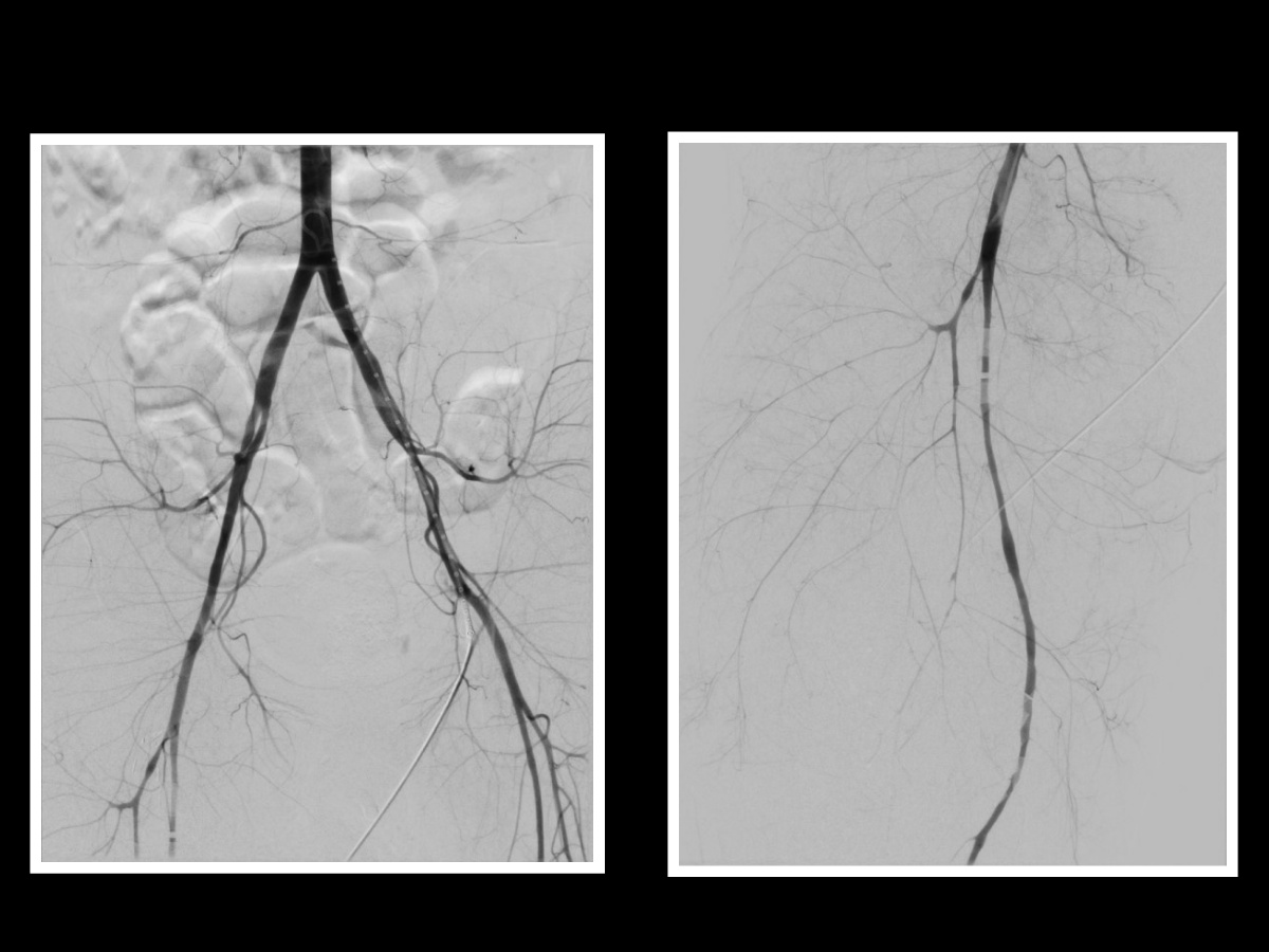 <p>Wound Imaging