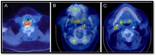 <p>Unknown Primary Cancer Detection