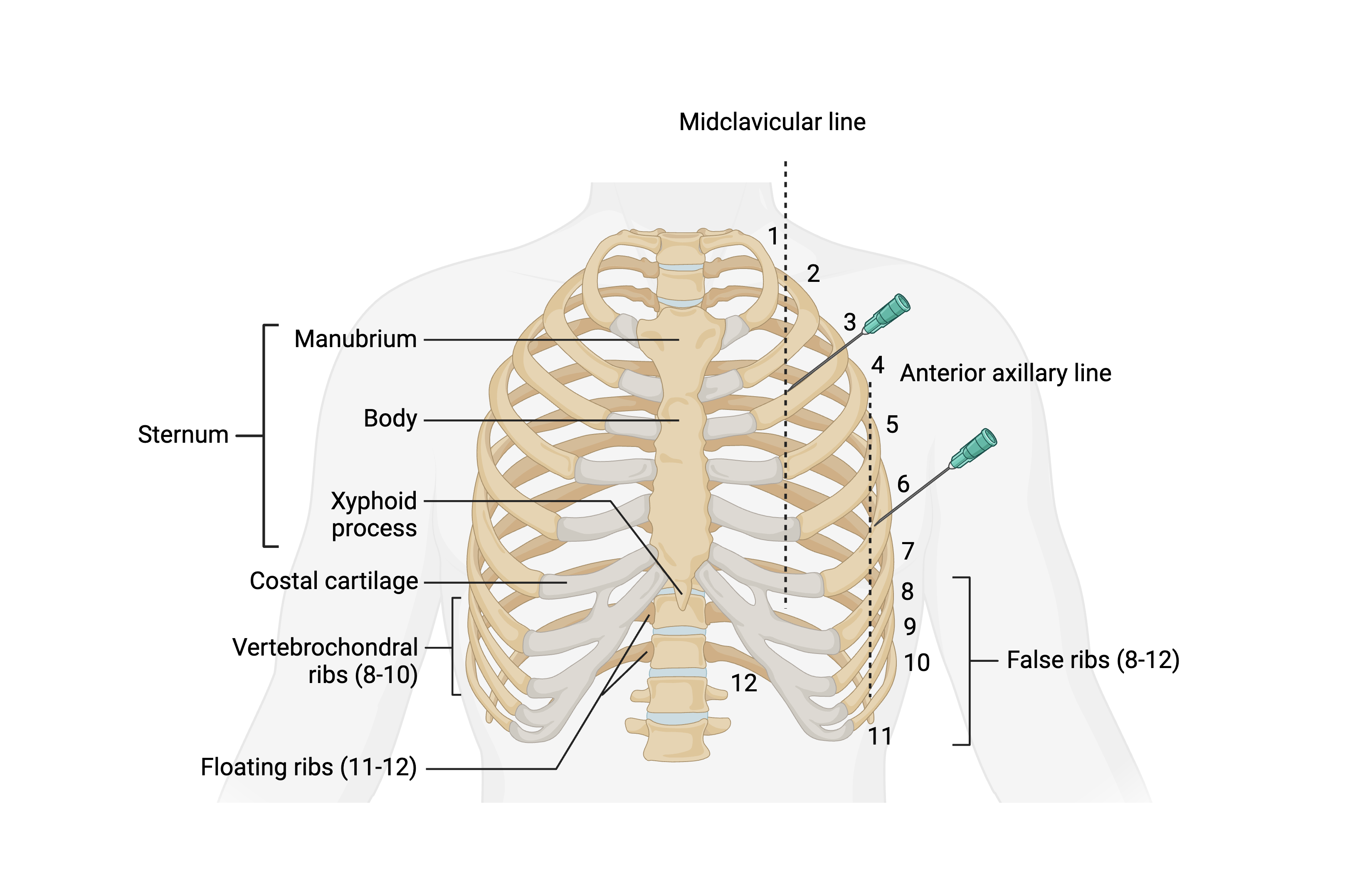 <p>Chest Wall Decompression