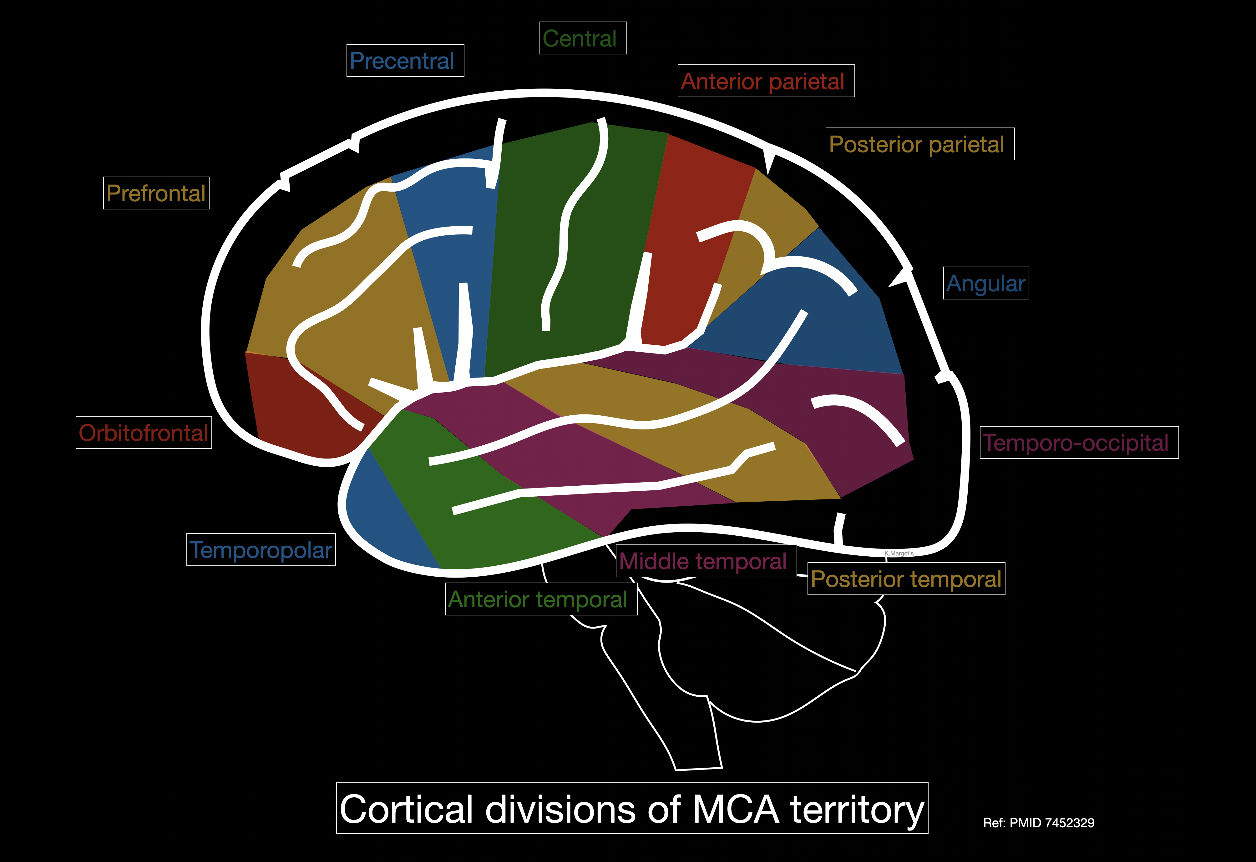 <p>Middle Cerebral Artery Cortical Divisions