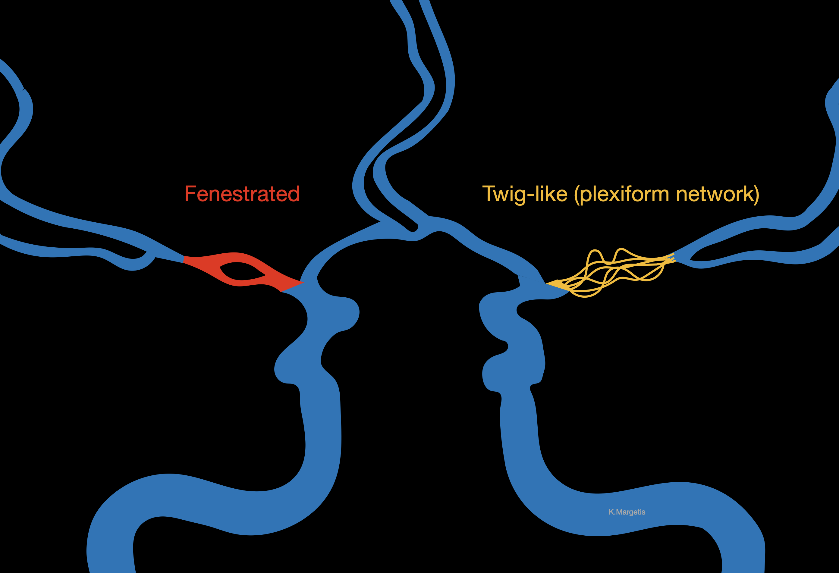 <p>Important Anatomical Variations of the Middle Cerebral Artery