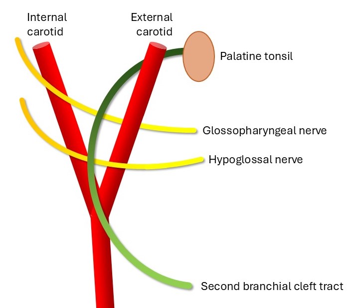 <p>Schematic of the Second Branchial Cleft Tract
