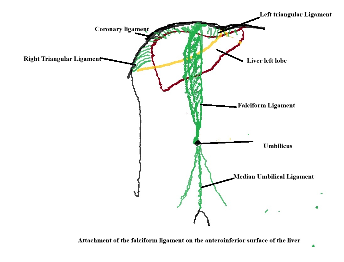 <p>Falciform Ligament Attachment on the Anteroinferior Liver Surface