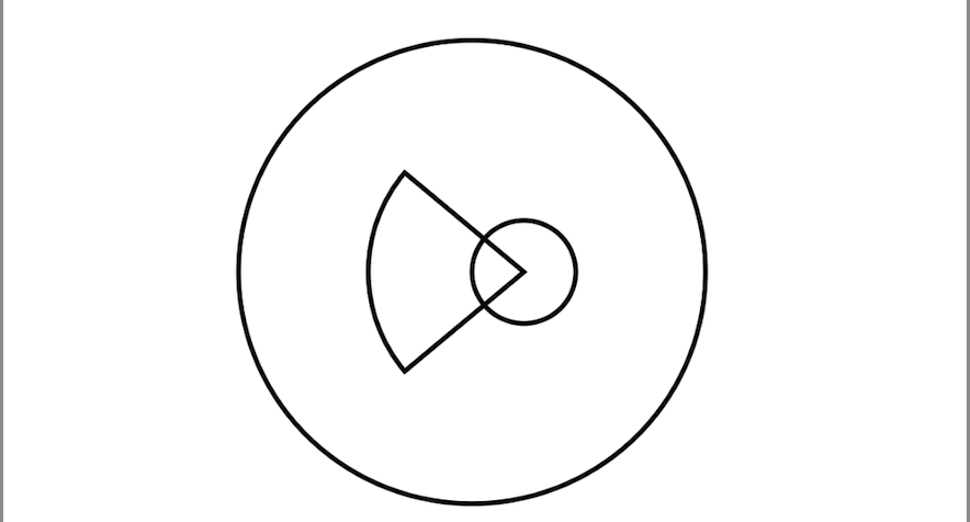 <p>Schematic Diagram Showing Chorioretinal Coloboma in Cat Eye Syndrome.</p>