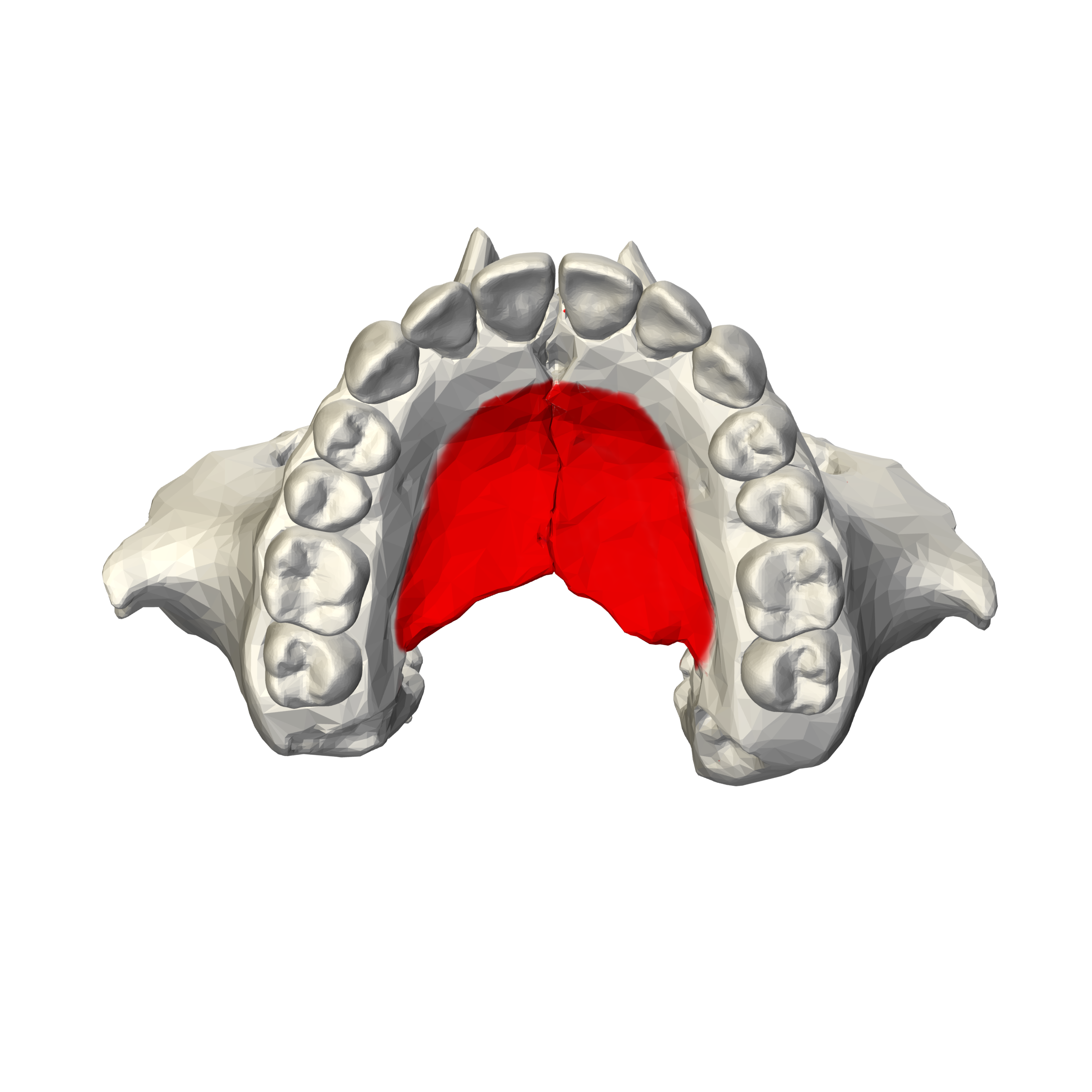 <p>Palatine Process of the Maxilla