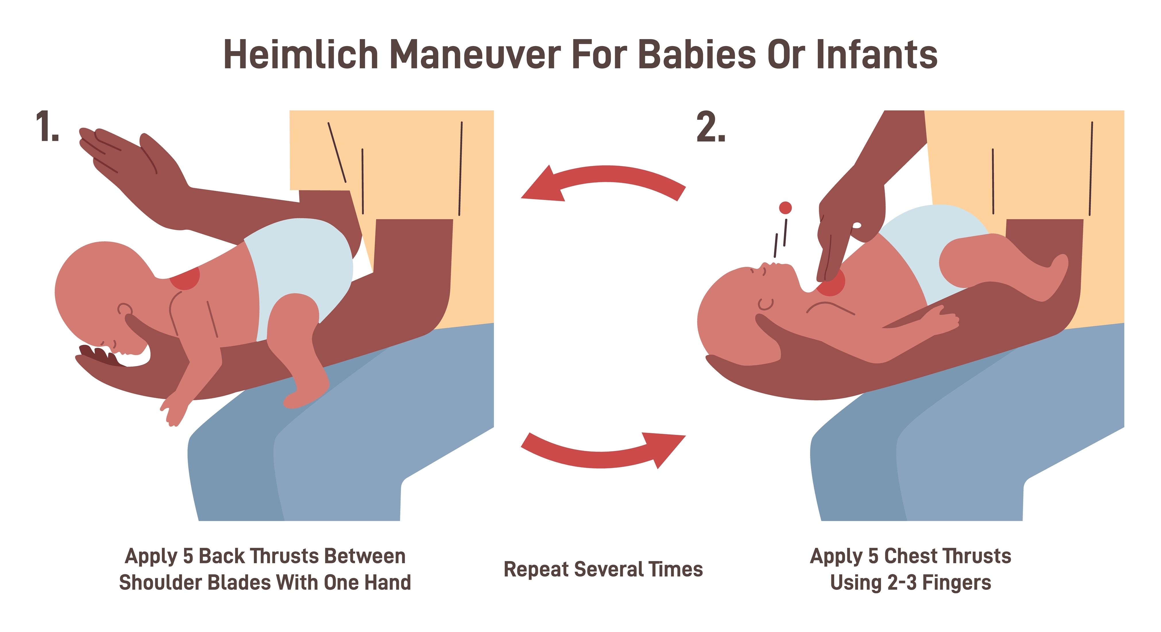 Heimlich Maneuver for Babies or Infants.
