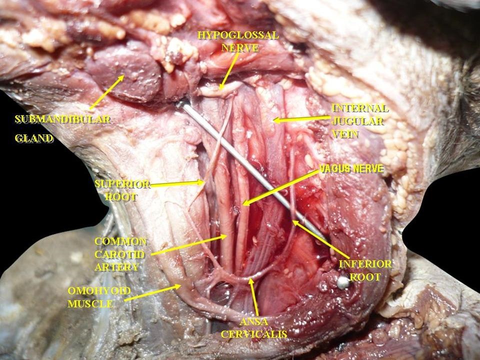 <p>Muscles, Arteries, and Nerves of the Neck
