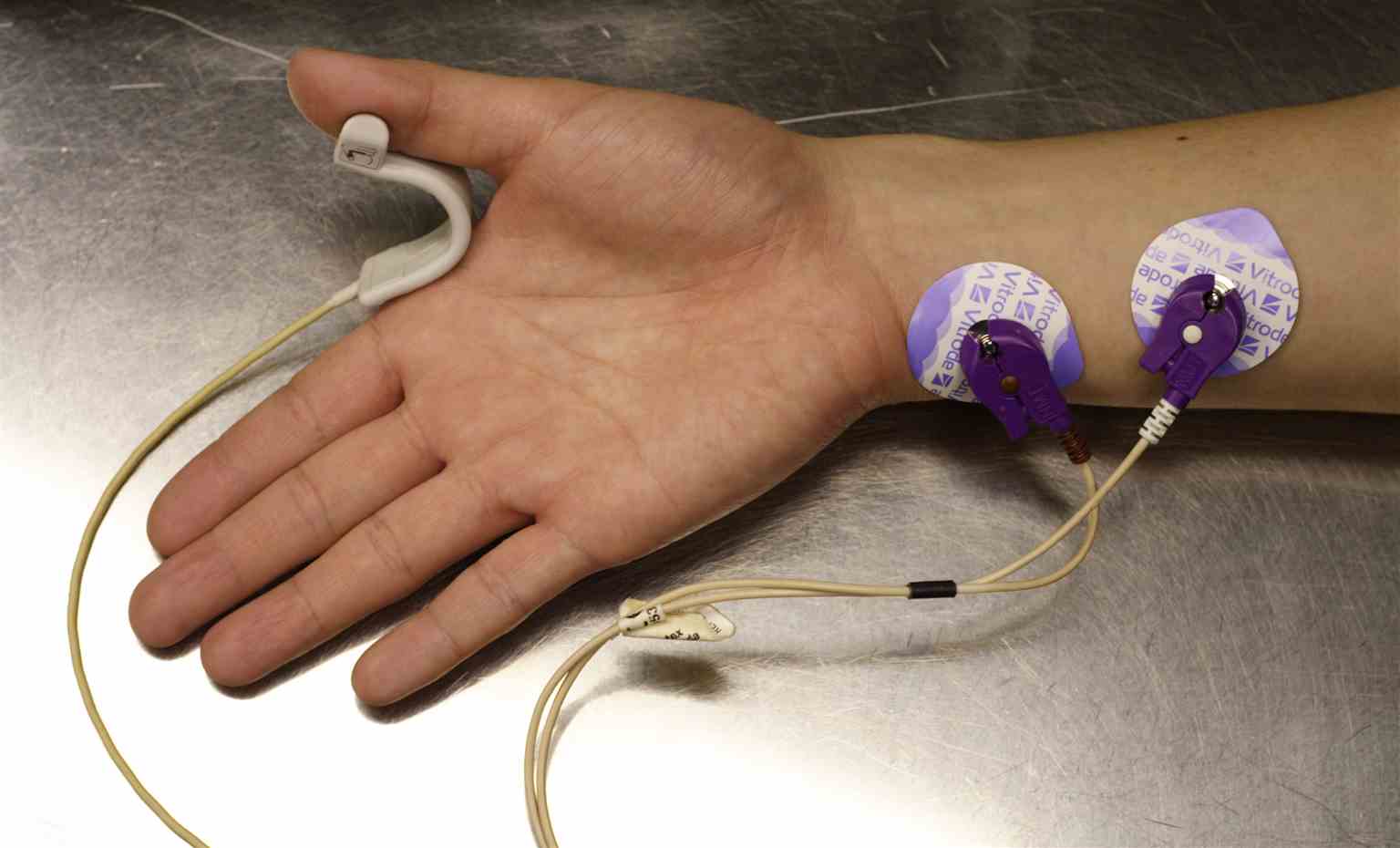 <p>Neuromuscular Transmission Monitor