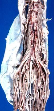 <p>Human Caudal Spinal Cord