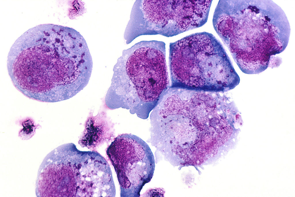 <p>Human Herpes Virus 6 Cellular Infection