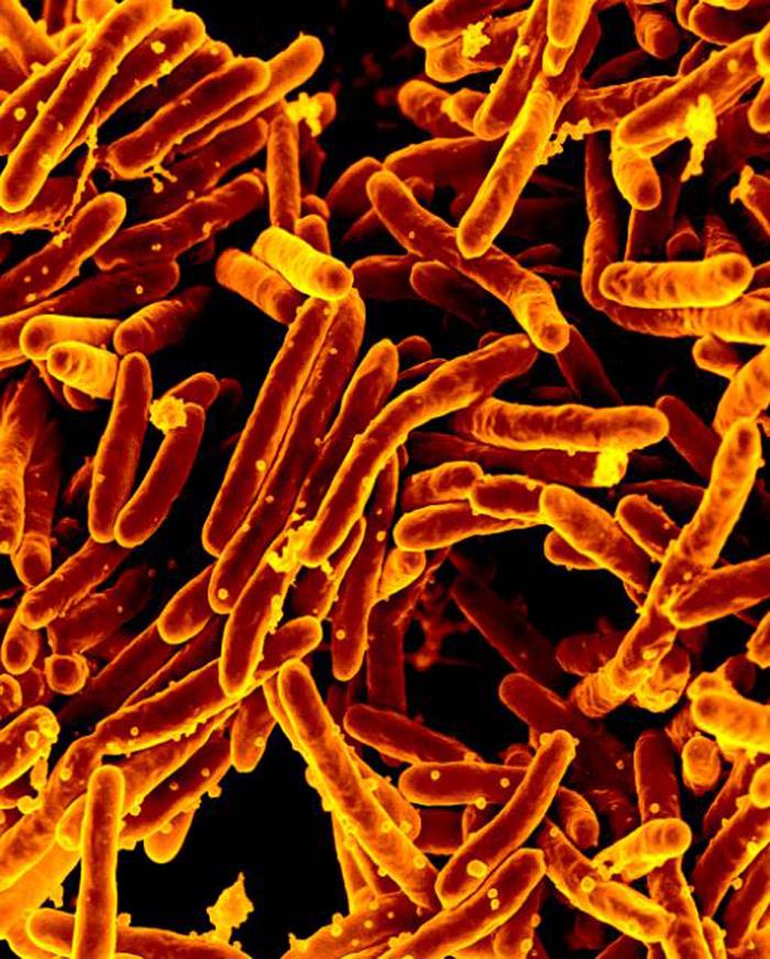 <p>Scanning Electron Micrograph. Rod-shaped Mycobacterium tuberculosis, bacteria.</p>