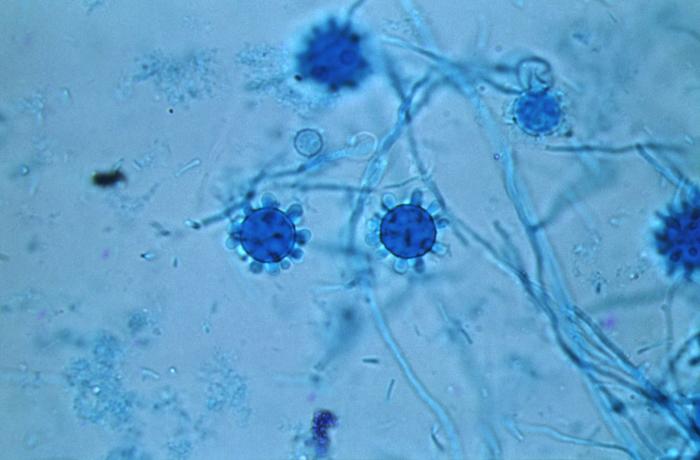 Histoplasma capsulatum