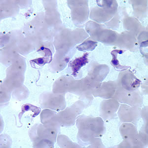 <p><em>Trypanosoma Cruzi.</em> Image of <em>T. cruzi,</em> the cause of Chagas disease, in Giemsa stained blood smear.</p>