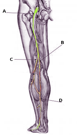 <p>Sural Nerves.</p>