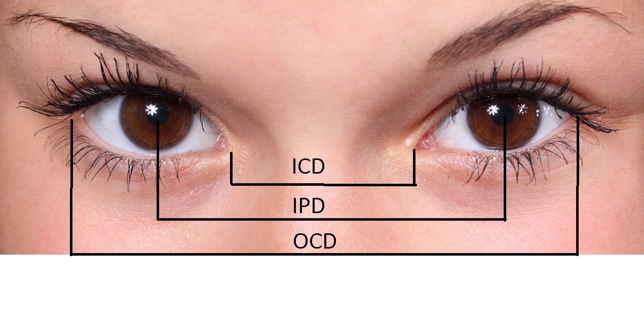 <p>Landmarks for Measuring Intercanthal Distance, Interpupillary Distance, and Outer Canthal Distance